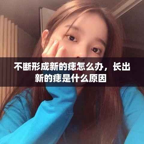 不断形成新的痣怎么办，长出新的痣是什么原因 