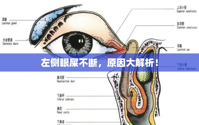 左侧眼屎不断,原因大解析!